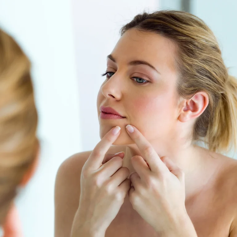 pimples-after-laser-hair-removal-featured